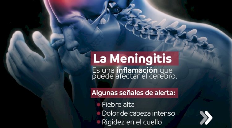 Meningitis: reconocer los síntomas puede salvar vidas