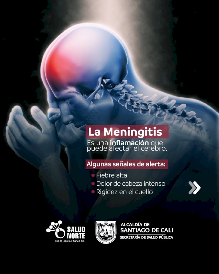 Meningitis: reconocer los síntomas puede salvar vidas